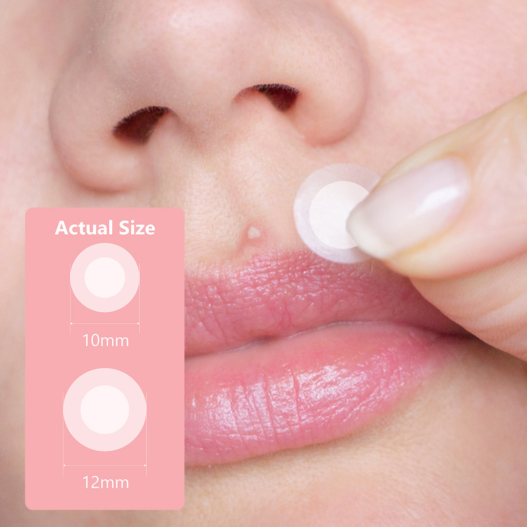 Floren Wonder Pimple Patch | Invisible Daytime Acne spot cover | Hydrocolloid Patch | For Zits, Blemishes, & Breakouts | Facial South Korean skin care | Drug-free, Gentle & Cruelty free | (30 (Pack of 1))