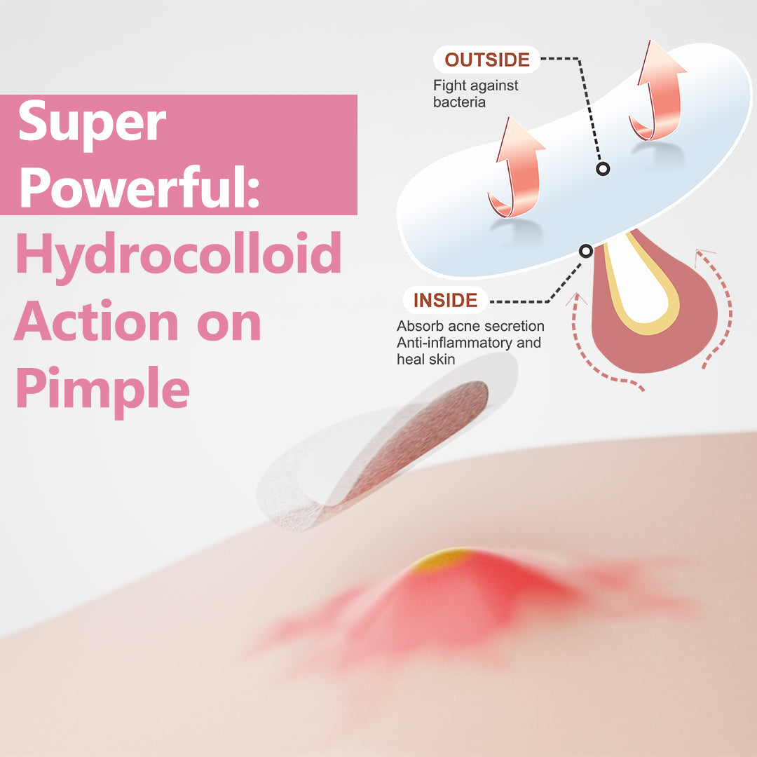 Floren Wonder Pimple Patch | Invisible Daytime Acne spot cover | Hydrocolloid Patch | For Zits, Blemishes, & Breakouts | Facial South Korean skin care | Drug-free, Gentle & Cruelty free | (30 (Pack of 1))