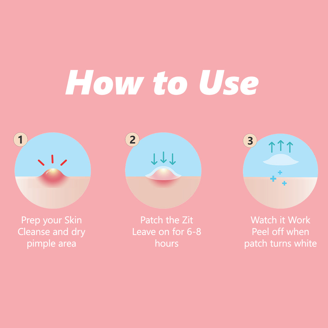 Floren Wonder Pimple Patch | Invisible Daytime Acne spot cover | Hydrocolloid Patch | For Zits, Blemishes, & Breakouts | Facial South Korean skin care | Drug-free, Gentle & Cruelty free | (30 (Pack of 1))