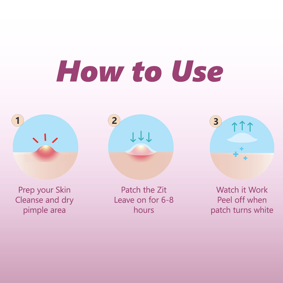 Floren Overnight Wonder Pimple Patch | Thicker Hydrocolloid Acne Patch | Effective & extra adhesion for better results | Facial stickers | Facial South Korean skin care | Drug-Free | 28ct (Pack of 1)